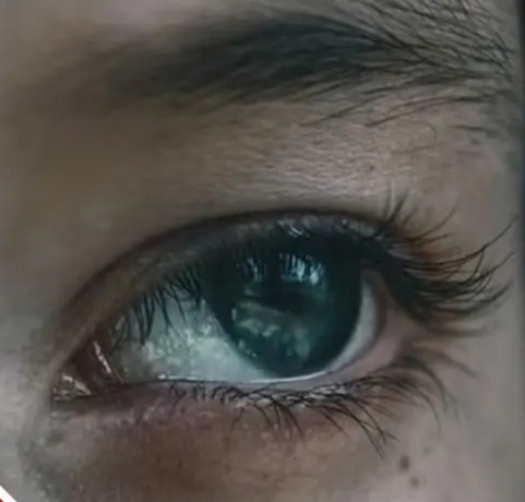 চোখের ৫ লক্ষণই বলে দেয় আপনার  কিডনি কোন অবস্থায় আছে।