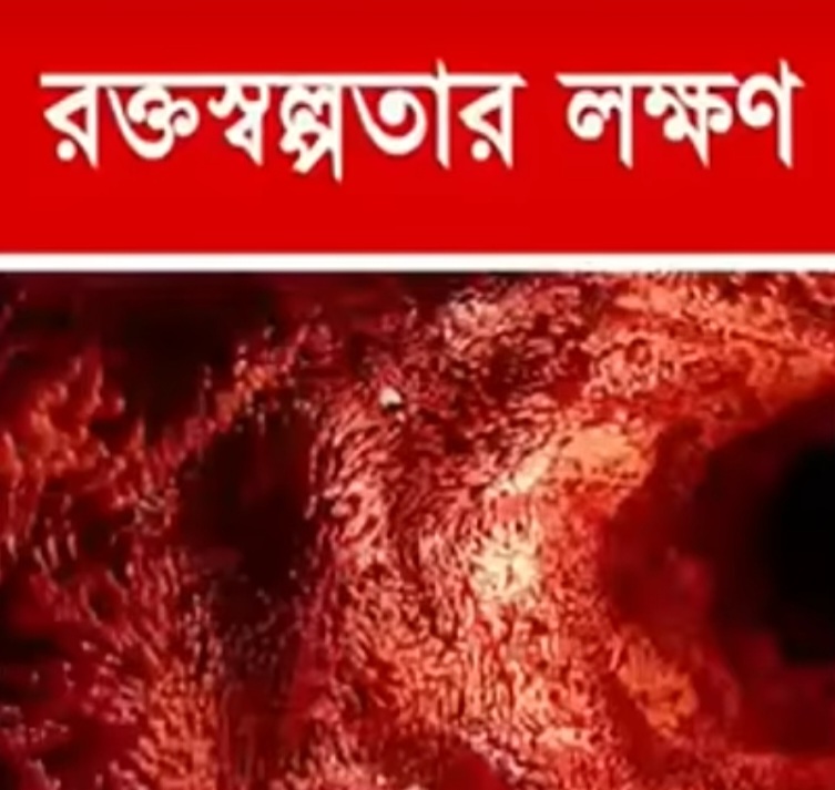 রক্তস্বল্পতার লক্ষণ।